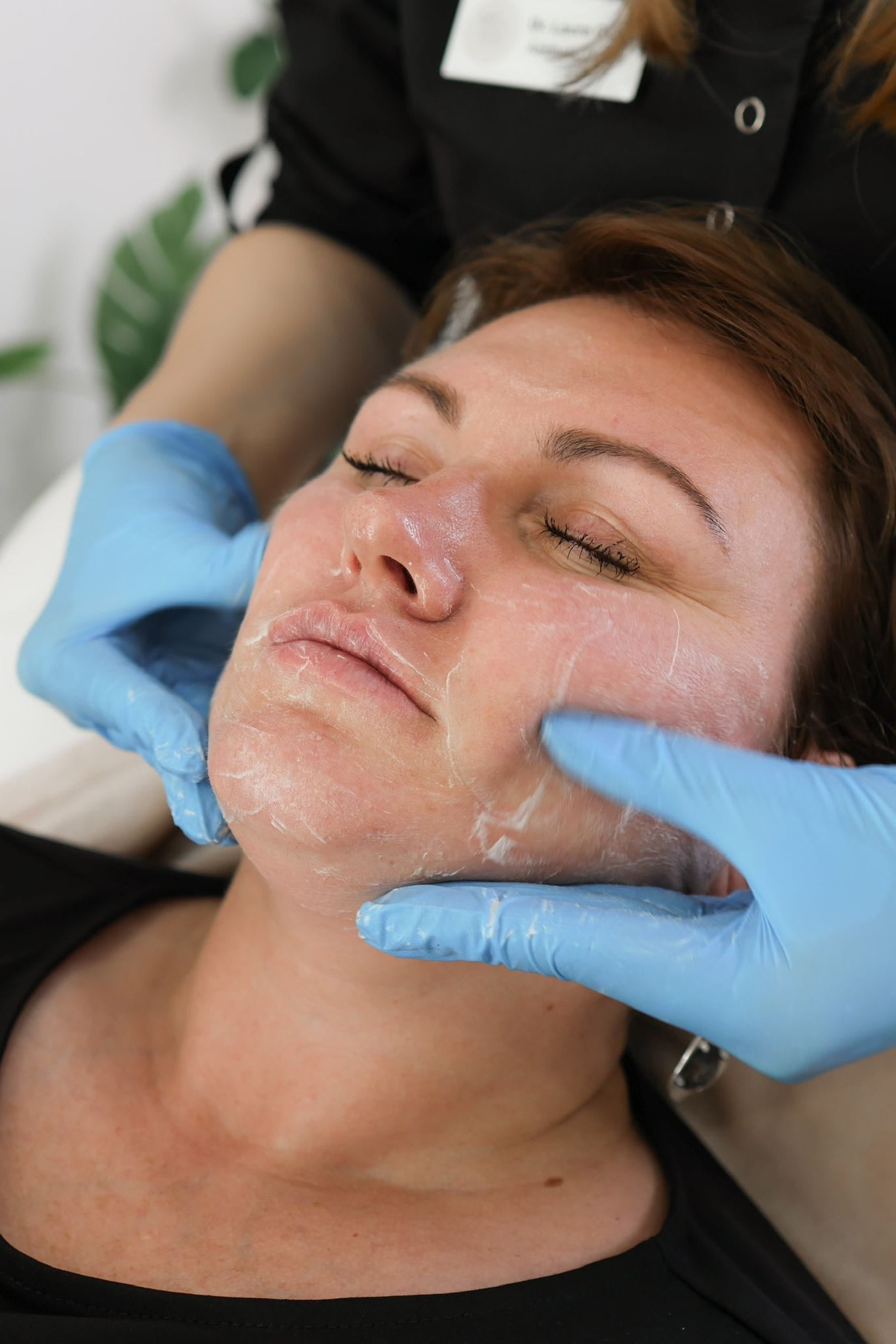 Cosmelan Depigmentation Peel: A Comprehensive Guide for UK Consumers