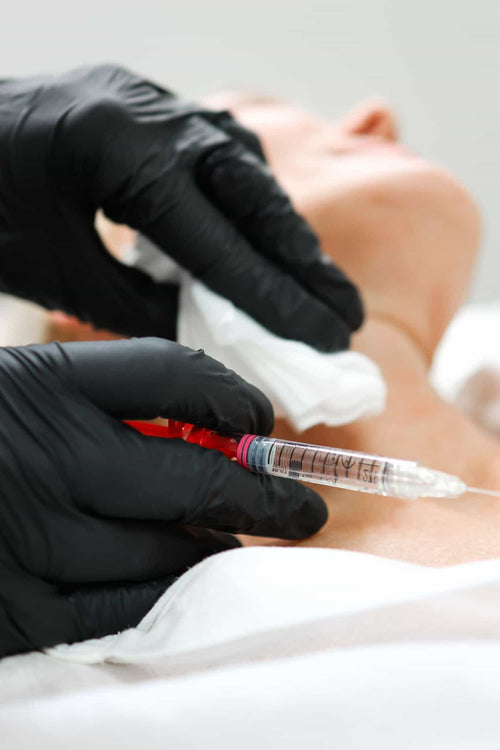 Where is nasal flare Botox placed?