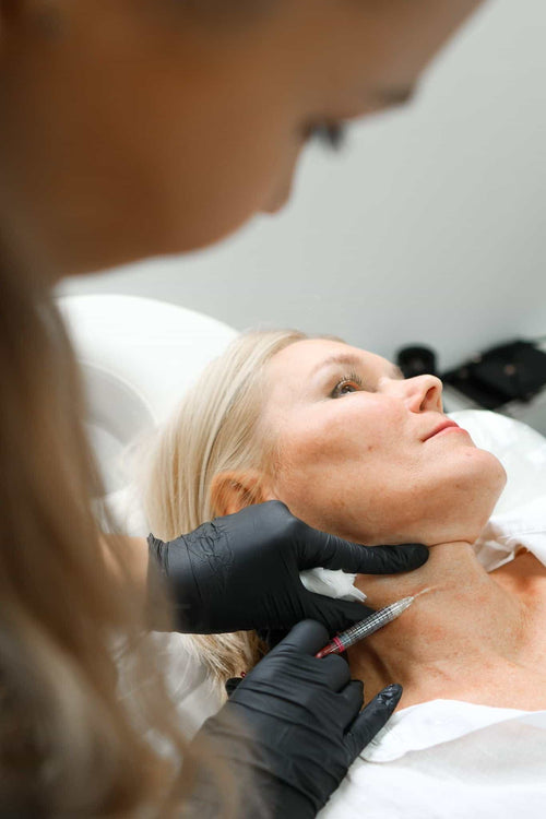 Where is nasal flare Botox placed?