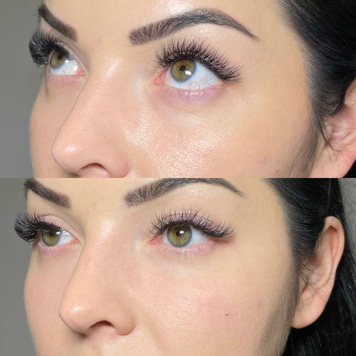 How Long After Lip Filler Can I Use Lipstick